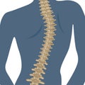 Osteochondrosis of the human spine.